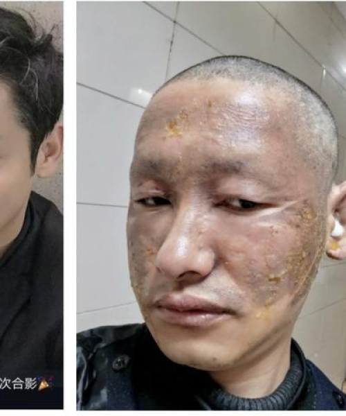 飞红滴翠